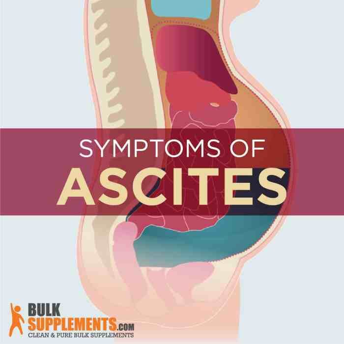 Can you suck in ascites